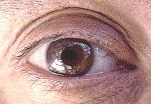 My eye